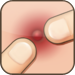 Pimple Popper Lite